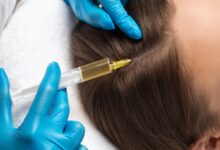 از ریزش مو تا رویش دوباره: چگونه پی‌ آر پی مو زندگی موهای شما را تغییر می‌دهد