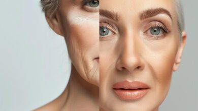 مزوژل‌های ایرانی با تکیه بر امنیت و کیفیت، رقیب جدی برندهای خارجی هستند
