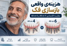 نقشه‌ی اقتصادی درمان دندان: از ترمیم ساده تا بازسازی کامل فک