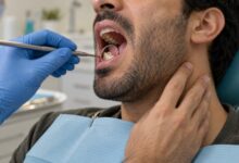 معاینه دندان عقل بیمار با درد زیر فک و گلو در مطب دندانپزشکی